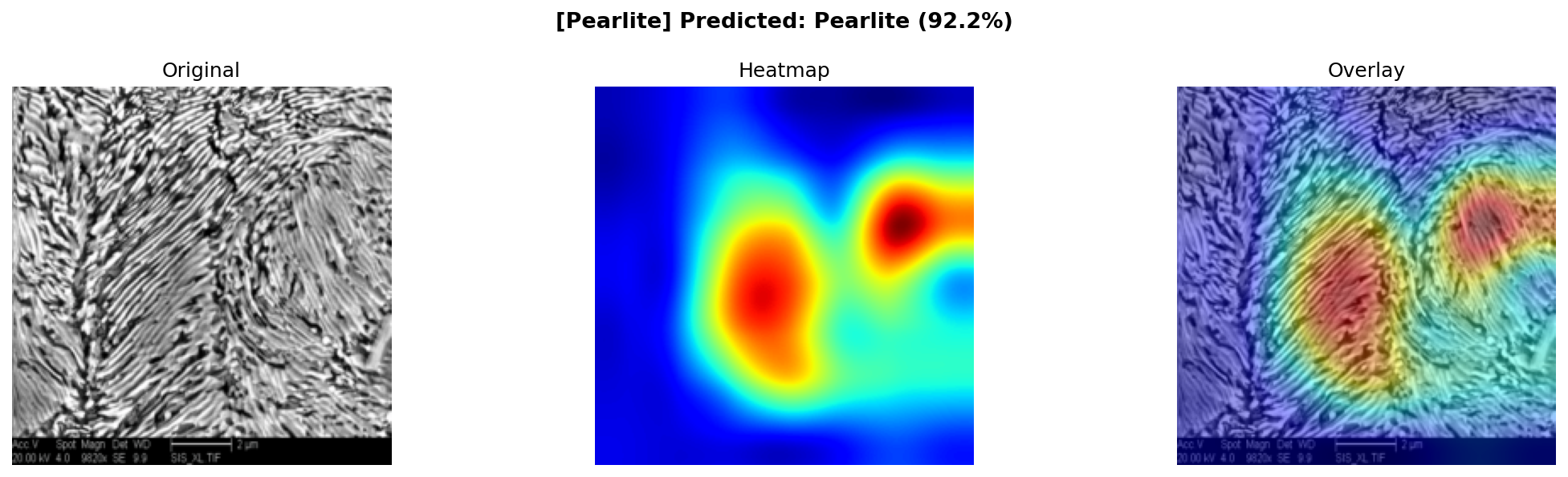 Pearlite